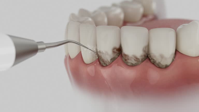 Reliable Wisdom Tooth Removal contractor in Dillon County County, SC by Dentist Open Now